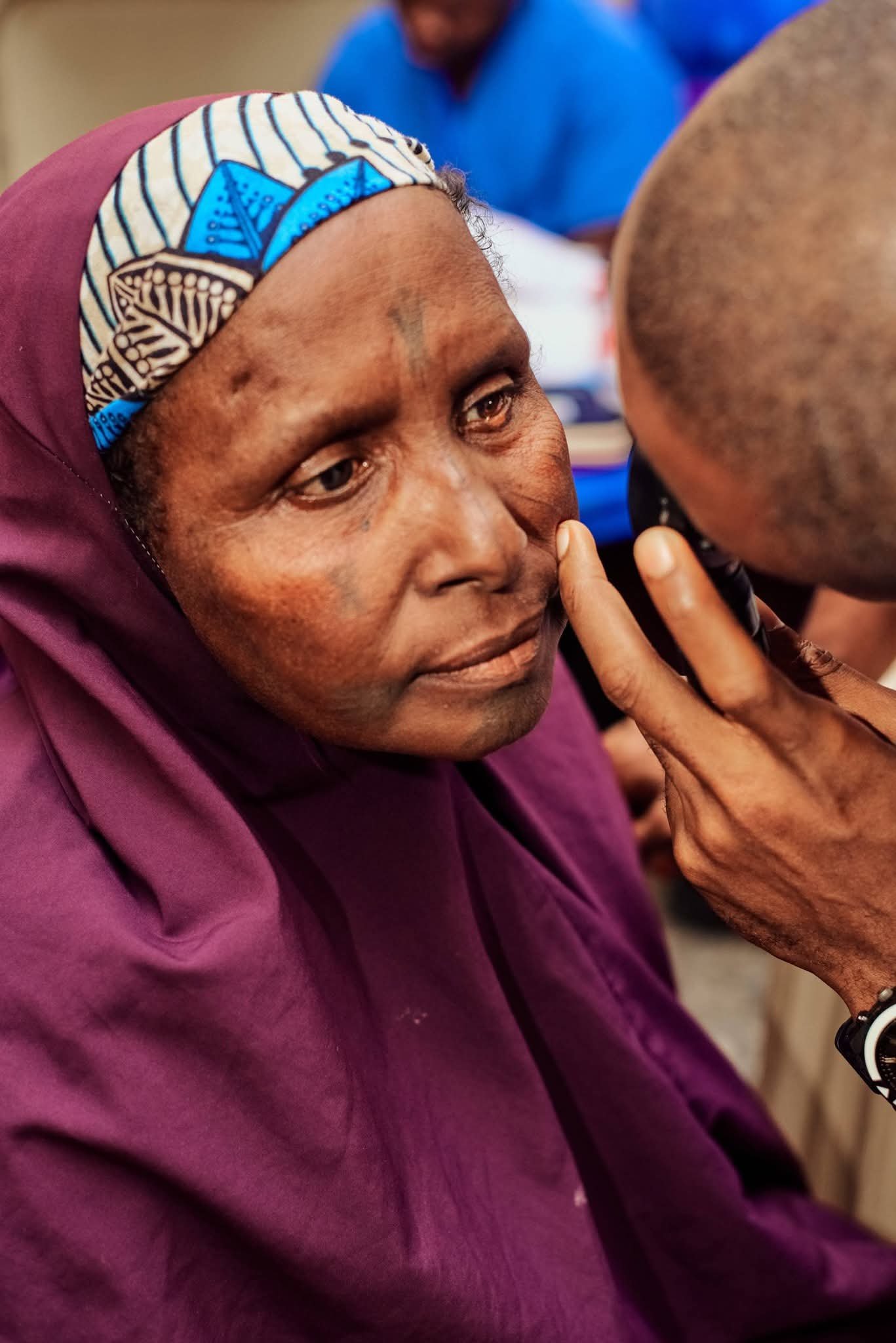 Close view of a clinician examining a participant’s eye.